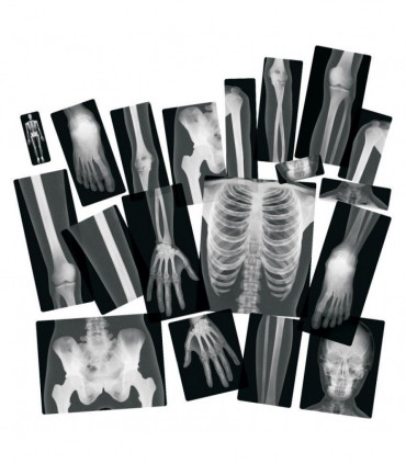 Röntgenové snímky ľudského tela, 18 častí